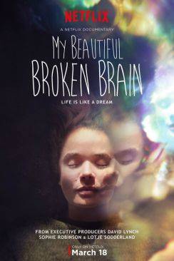 My Beautiful Broken Brain wiflix